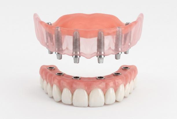Prothésiste pour dentiste Prothésiste pour dentiste