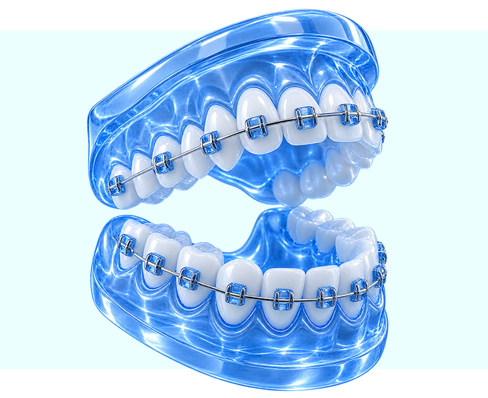 création 3D implant