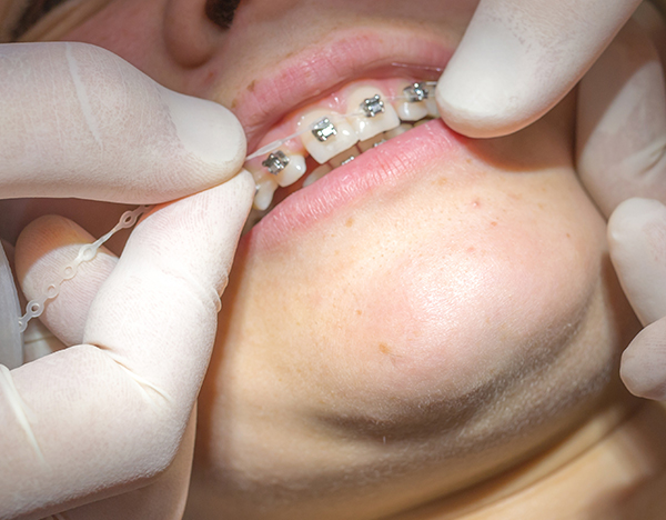 Orthodontiste près de Douai